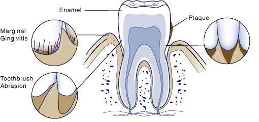 first-bite-dental-general-dentistry-sensitive-teeth-sensitive