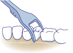 dental-flossettes How to use a dental flossette