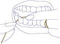 dental-flossing-how-to-floss-step-2 Step 2: How to floss between your teeth