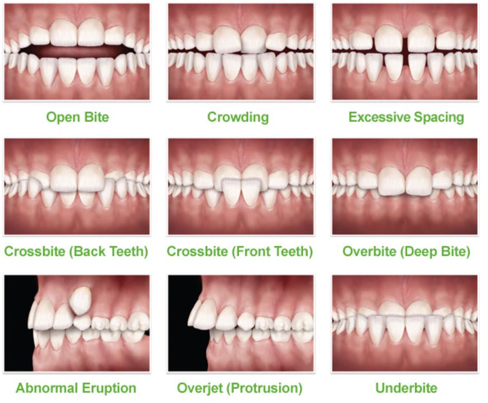 Phase 1 Orthodontic Problems