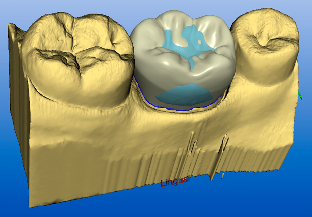 cerec-ac-software3