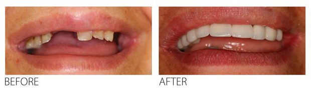 creating-oral-health-plan-firstbite-dental