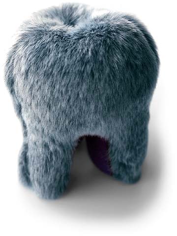 furry tooth caused by bacteria Melbourne dental patient furry tooth caused by bacteria Melbourne dental patient