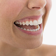 tooth coloured fillings cosmetic dentist Essendon Melbourne