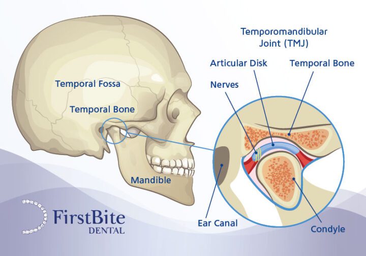 What is TMJ dysfunction TMD temporomandibular joint disorder jaw diagram Melbourne dentist Essendon