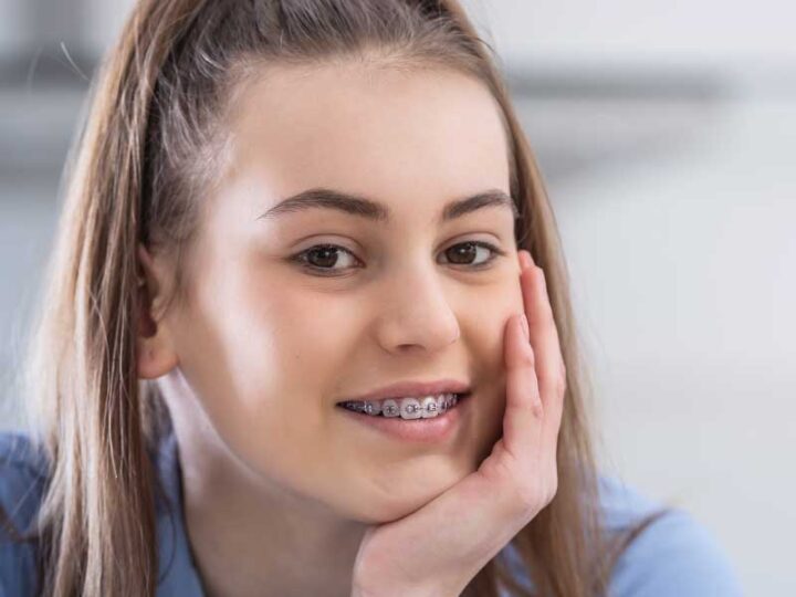 traditional metal braces worn by Melbourne smiling teen orthodontics Essendon clinic